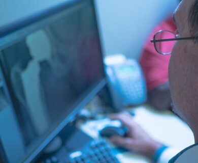 A person is sitting in front of a computer monitor reviewing a medical image, possibly an X-ray, in a professional setting. Person reviewing a medical X-ray on a computer monitor in an office setting.
